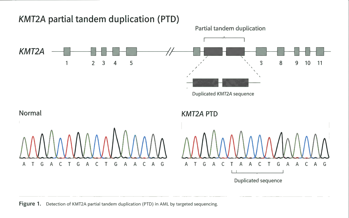 Figure: the KMT2A exon map with a partial tandem duplication, and normal versus PTD sequencing traces.